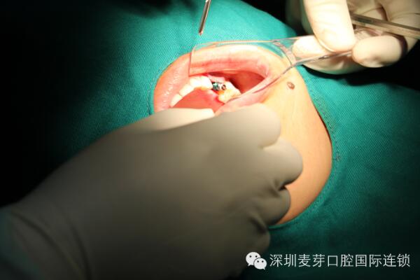 民意是为健康牙为先