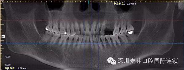 民以食为天健康牙为先