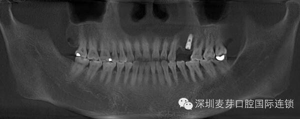 民以食为天健康牙为先