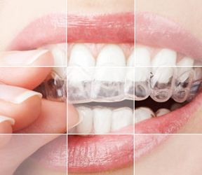 深圳牙科医院哪家好