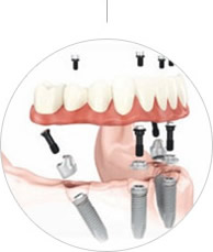 专业的种植系统